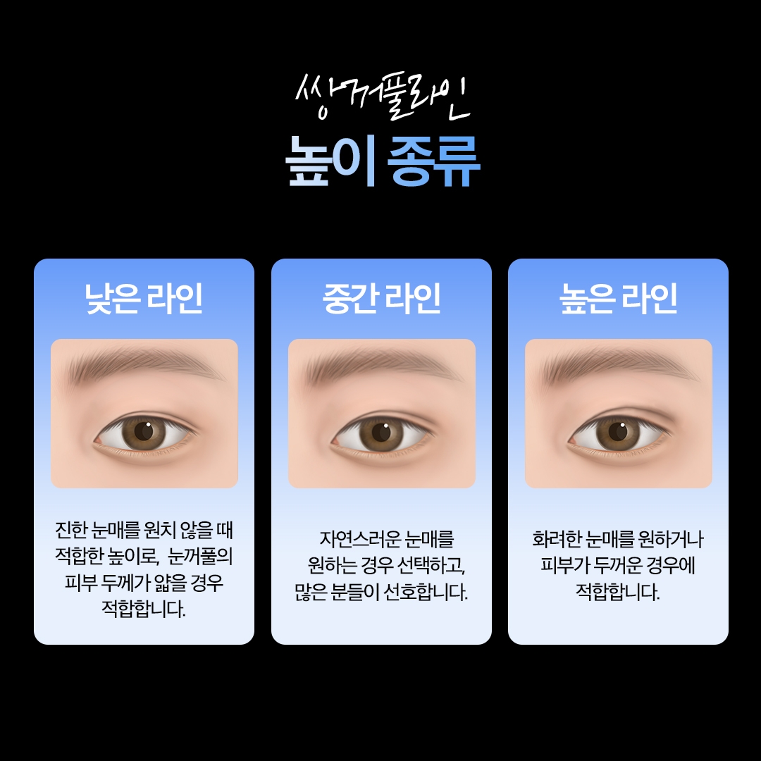 남자 눈매교정 (5)