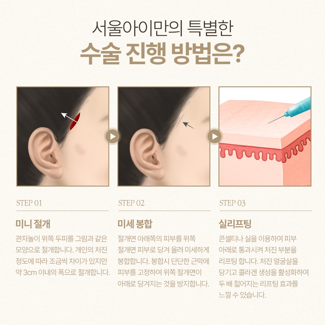 관자리프팅 (6)