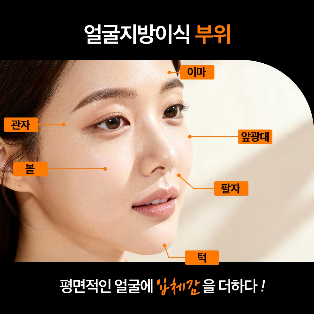PRP 풀페이스지방이식 (4)