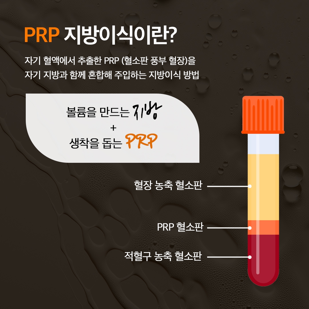 PRP 풀페이스지방이식 (3)